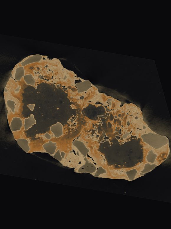 Abstract, microscopic-style close-up of an ochre-colored, mottled organic shape set against a dark, subtle textured background.